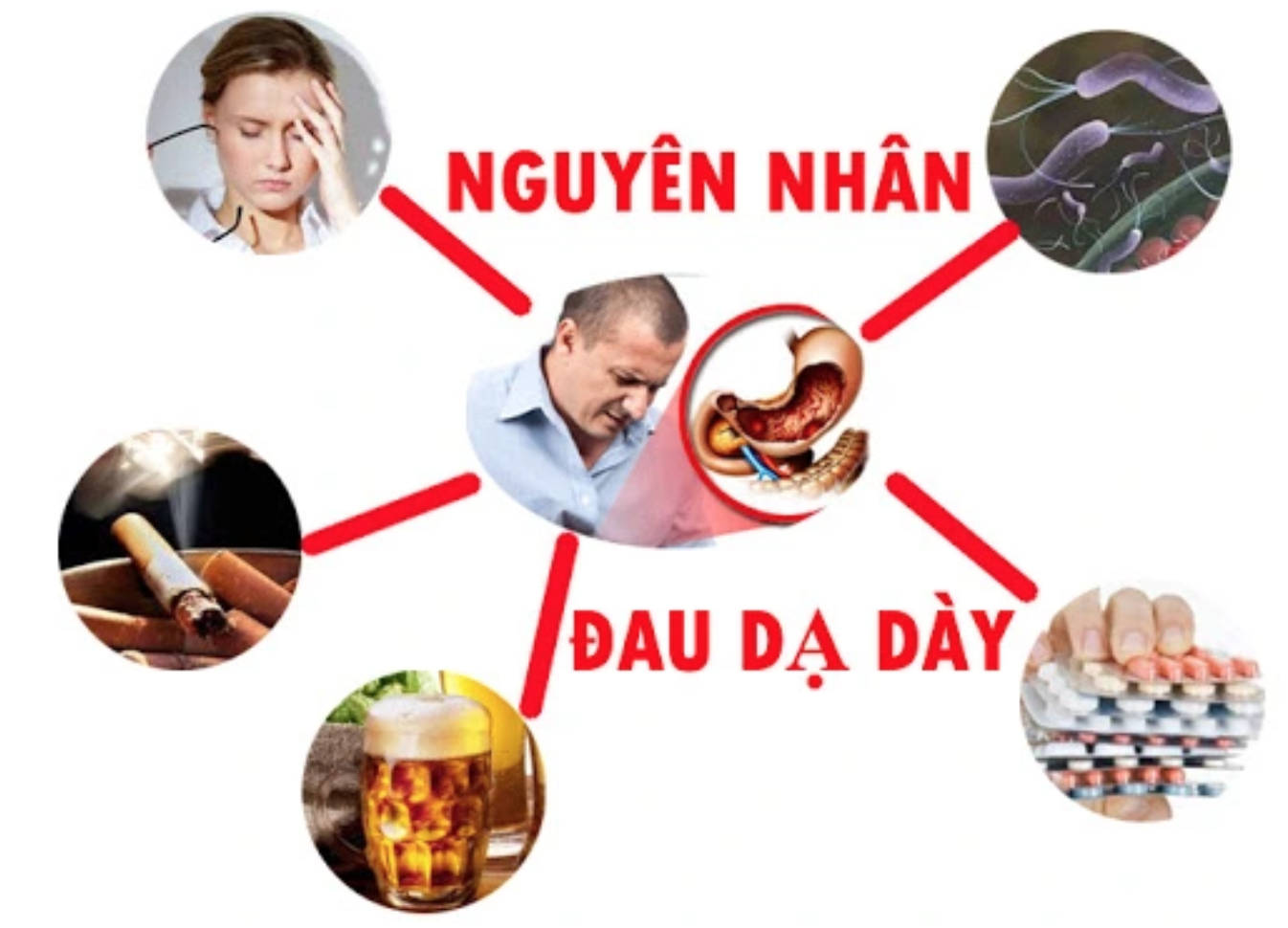 Viên dạ dày plus - Bước cải tiến mới giúp hỗ trợ giảm các triệu chứng dạ dày tá tràng từ sâu bên trong